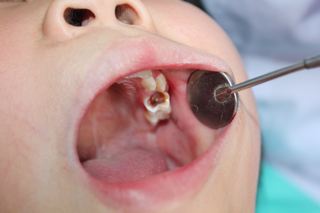 0-6岁儿童口腔清洁全攻略 科学选择用品与养成卫生习惯